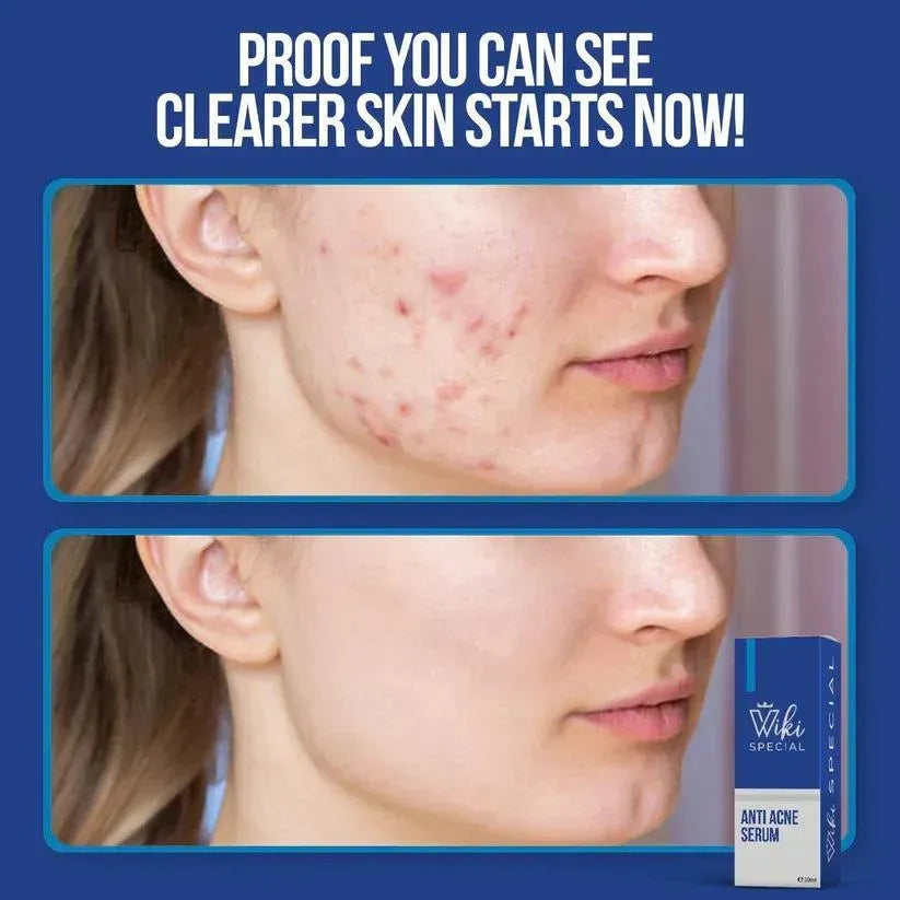 Viki Skin Brightening serum