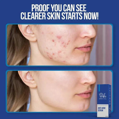 Viki Skin Brightening serum