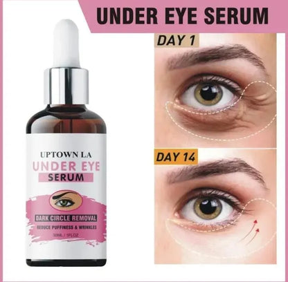 Dark Spots Removal Eye Serum